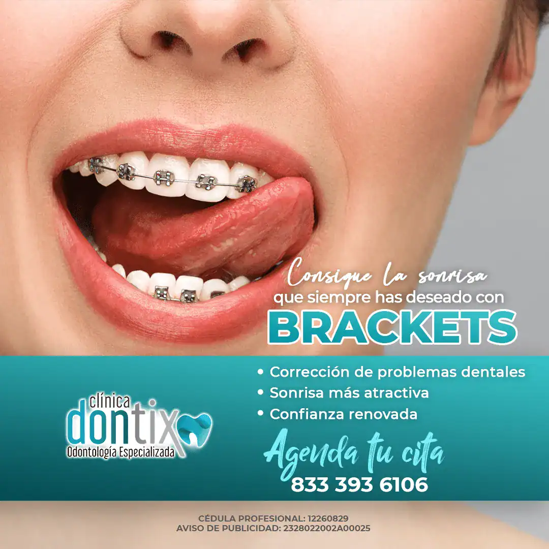 FLYER BRACKETS